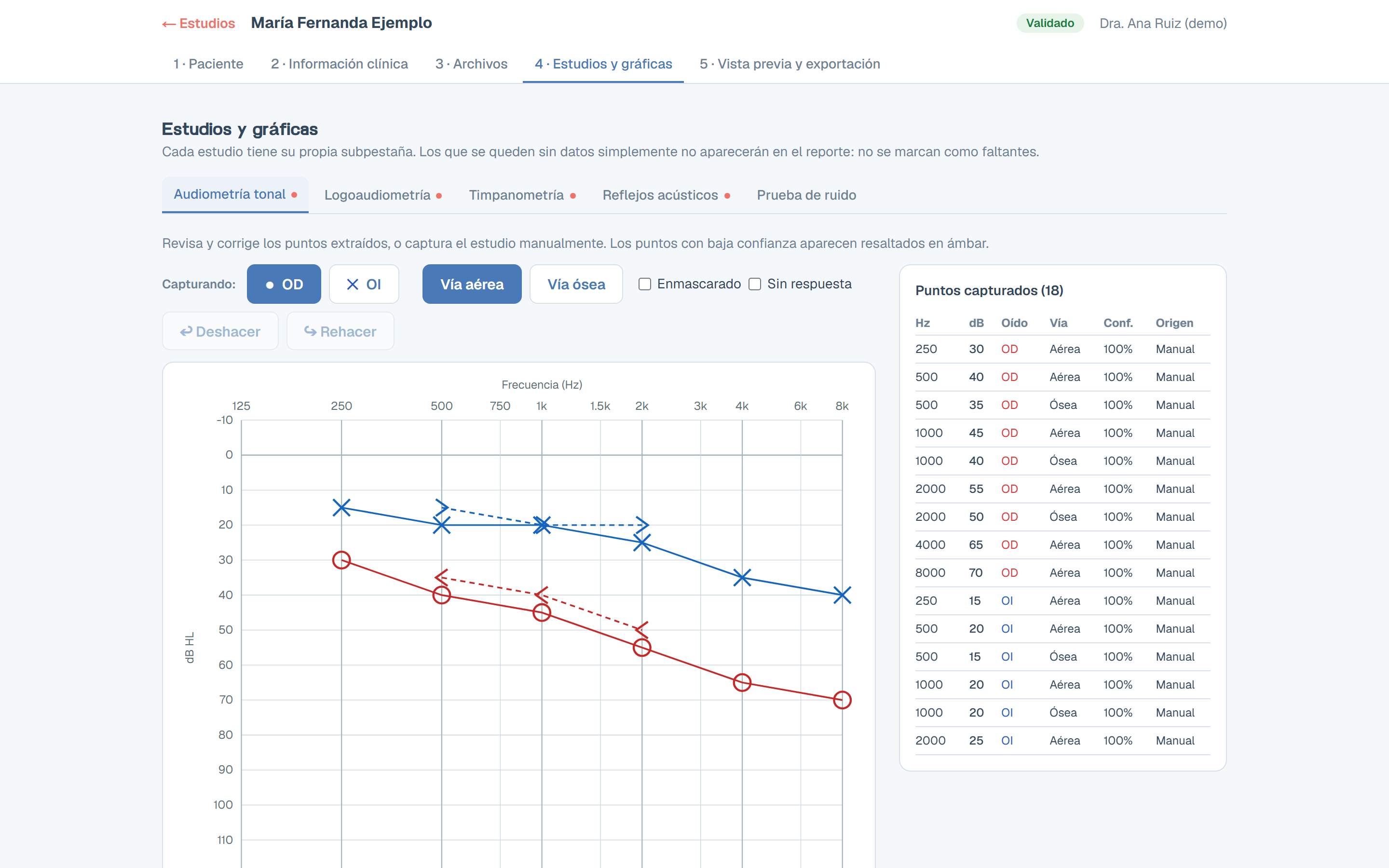 Audiogram editor: five-step progress, capture by ear and conduction, undo and redo, and a table of captured points with confidence and source