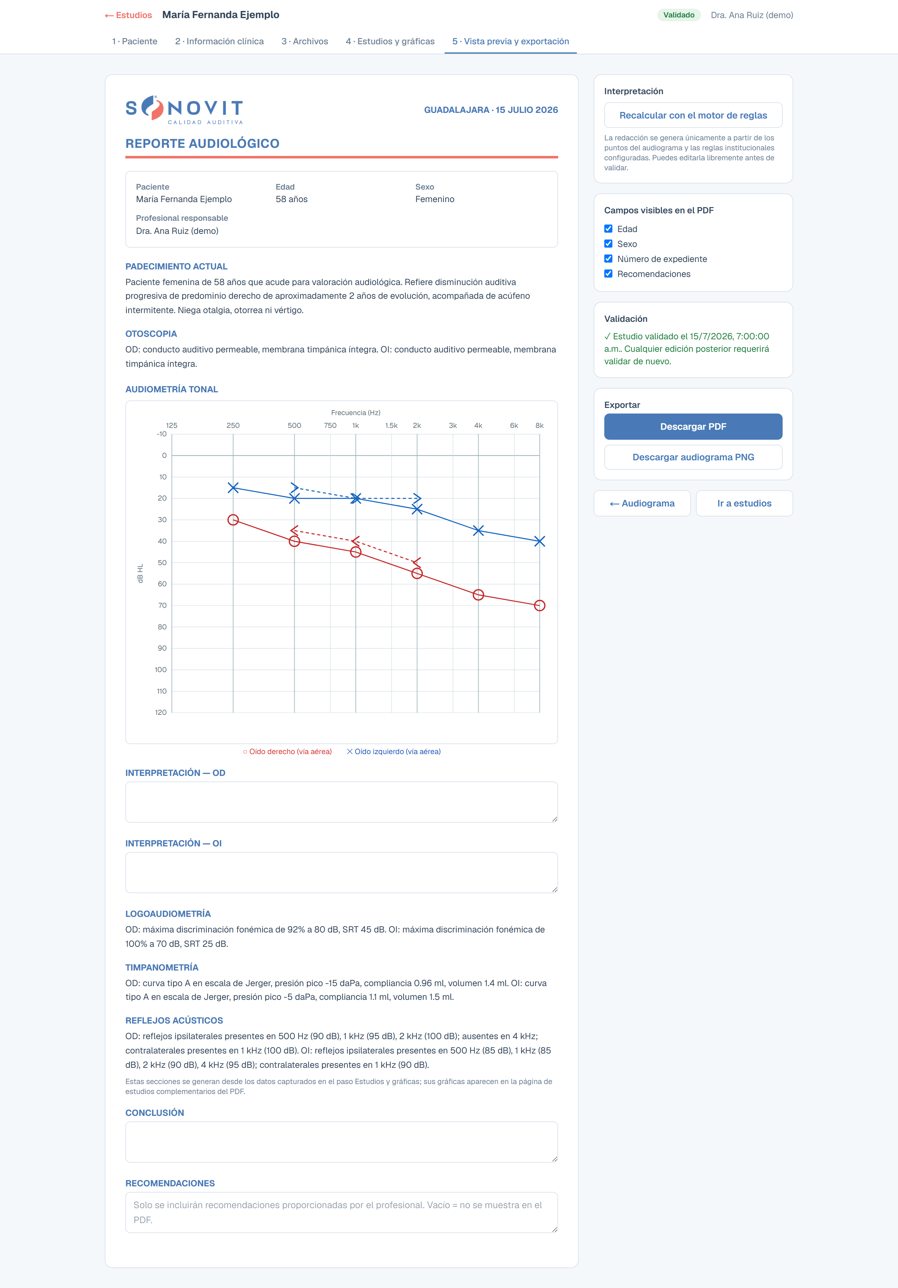 Preview and export step: editable interpretation, validation state and export